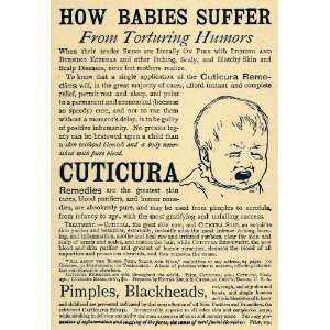  1892 Ad Potter Drug Chemical Cuticura Baby Remedies Skin 