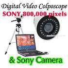 Digital portable Video SONY 800,000 Electronic Colposco