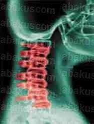Cervical Neck Traction for Headache Back Shoulder Neck Pain  