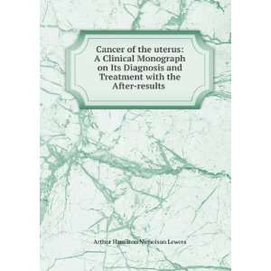  Cancer of the uterus A Clinical Monograph on Its 