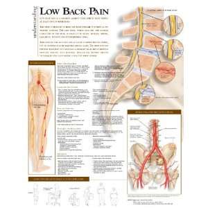  Understanding Low Back Pain Laminated Chart Health 