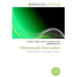  Melanocytic Oral Lesion (9786134029803) Books