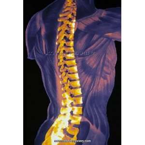  Coloured 3 D CT scan of the human spine Photographic 